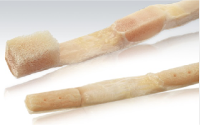 Evidence for Allograft use in ACL reconstruction