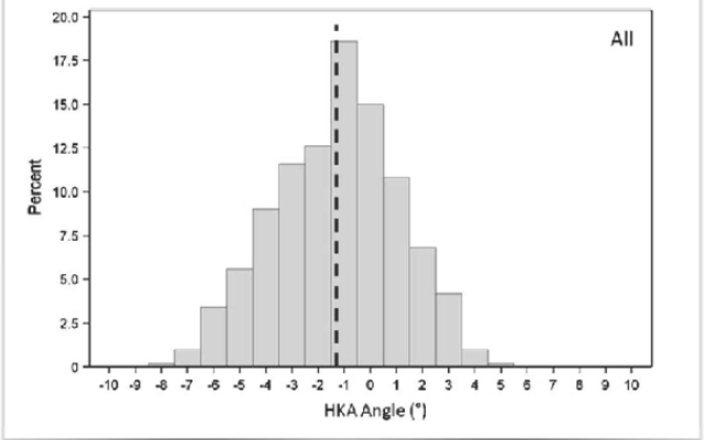 Computer Navigation is for the Outliers!!!!!!