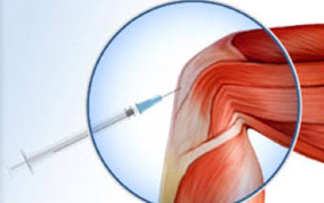 Platelet Rich Plasma (PRP) - Latest Evidence or Lack of !!!